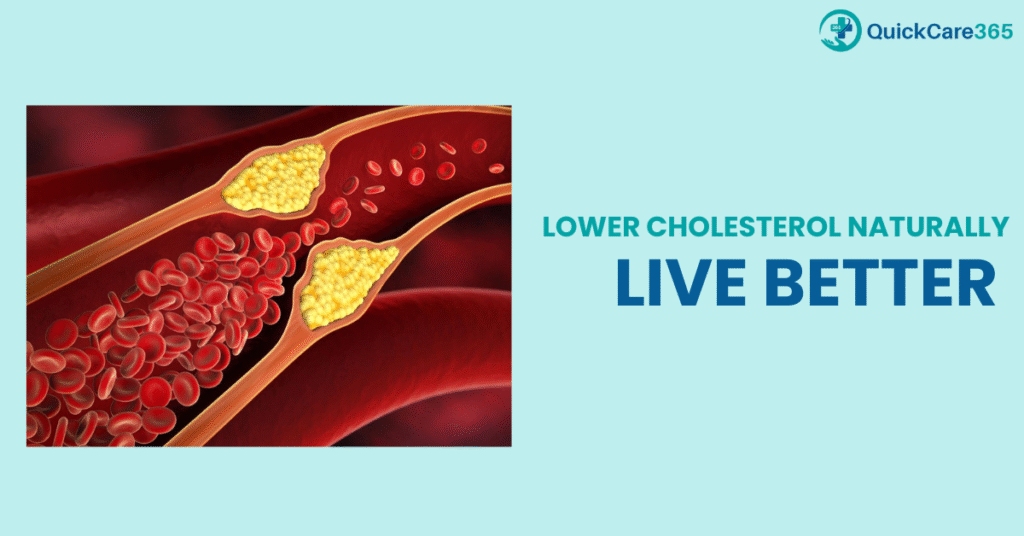 Lower Cholesterol Naturally | QuickCare Telehealth USA