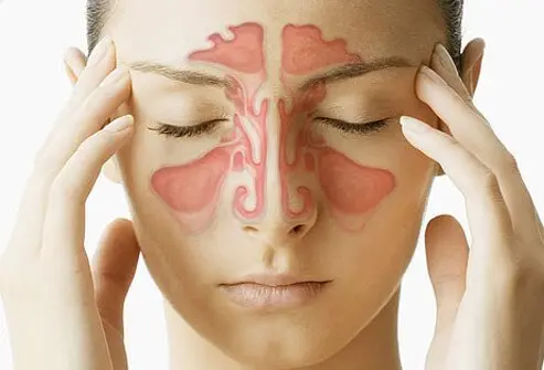online doctor for sinus infection